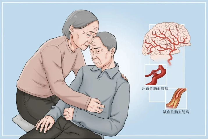 脑血管疾病急救措施分享